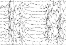 EEG Ströme bei einem Gewitter die ausschläge sin unkoordiniert in höhe und Länge.